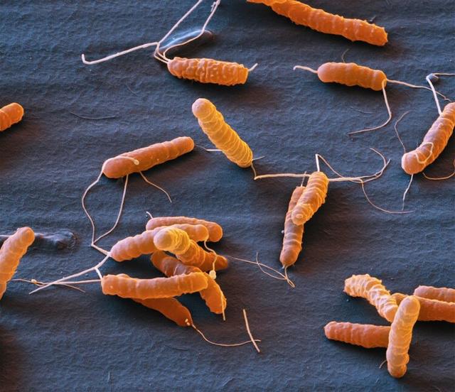 阿莫西林和头孢的区别在哪里（世界上两大抗生素）(3)