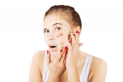 ​祛痘产品排行榜十强（祛痘美容品牌怎么选）