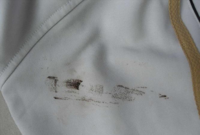 衣服血渍清洗小妙招