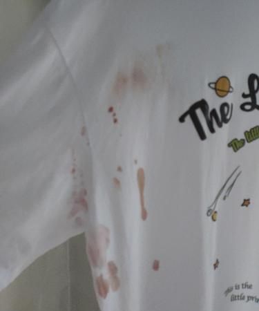 血弄到衣服上妙招去除