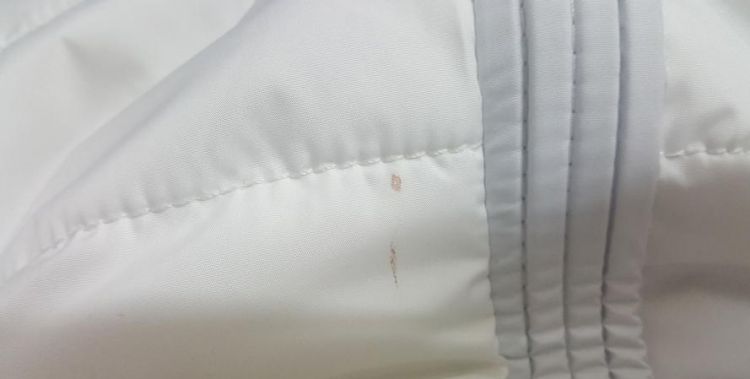 衣服上有血迹怎么办