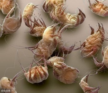 ​去螨虫的最有效方法（去螨虫的最有效方法介绍）