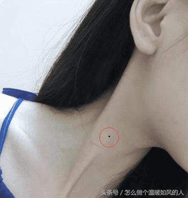 脖子上有三颗痣连着的好吗（脖子上的痣能不能点）