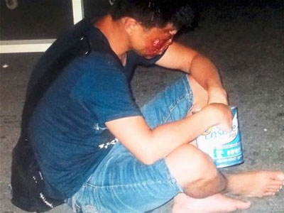 实拍被拐卖致残的孩子，人贩子被抓时，真叫大快人心！