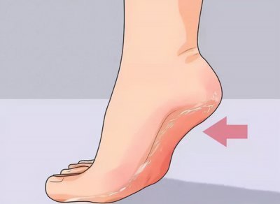 ​脚脱皮是什么原因造成的（为什么脚会“脱皮”？脚丫脱皮莫忽视，可能和这4个