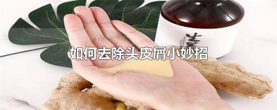 ​生活小妙招去头皮屑 生活小妙招,怎么样去除头皮屑呢