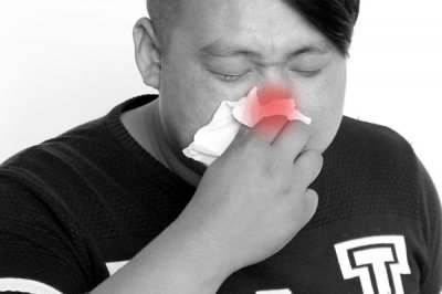 ​怎么治疗过敏性鼻炎 过敏性鼻炎应如何治疗？做好这3点，鼻炎可能慢慢远离你
