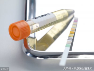 ​肾病综合征能治愈吗 这5件大事，时时都要谨记