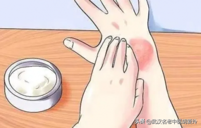 ​手指脱皮是什么原因造成的（手脱皮是什么原因导致的不痒不痛该擦什么药）