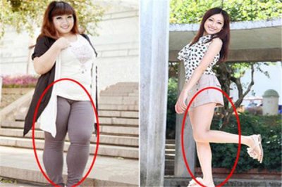 ​哪些坏习惯会导致大象腿 导致大象腿的原因