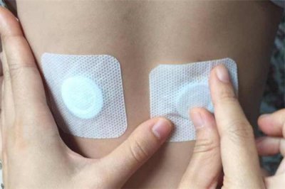 ​三伏贴为什么会发热 三伏贴能治老寒腿吗