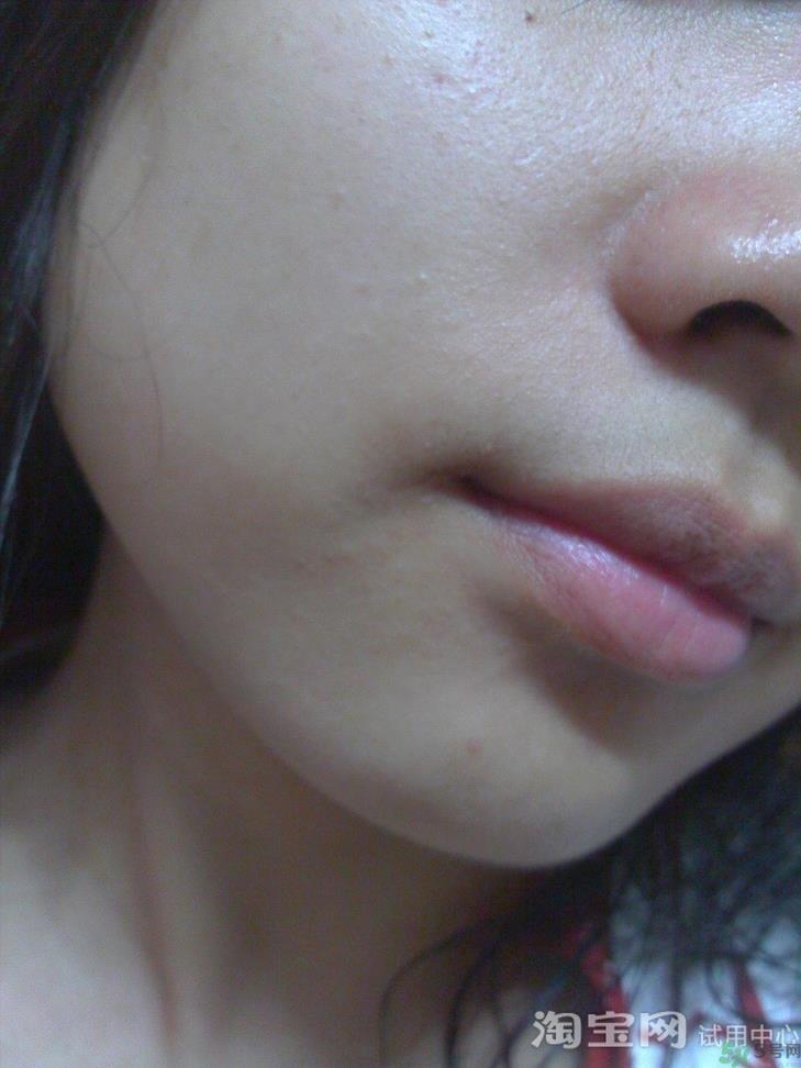 forencos面膜怎么用?forencos面膜使用方法 forencos面膜怎么用?forencos面膜使用方法