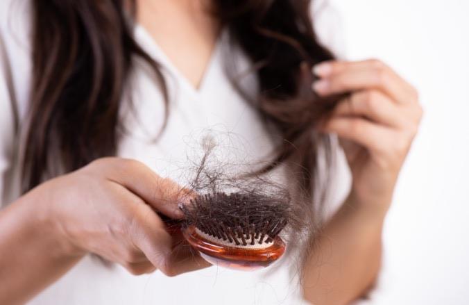 生活年轻人脱发的四大原因 防治脱发的5大误区  1