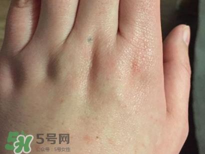 薇诺娜适合什么皮肤?薇诺娜适合敏感肌吗? 薇诺娜适合什么皮肤?薇诺娜适合敏感肌吗?