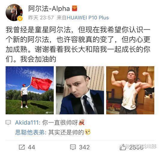 童星阿尔法“秃然长大”引热议, 回应求生发方法, 网友暖心安慰