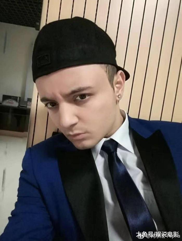 童星阿尔法“秃然长大”引热议, 回应求生发方法, 网友暖心安慰