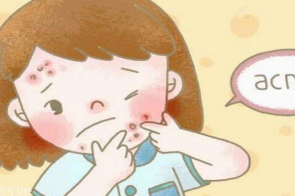 敷尔佳敷完要不要洗脸 敷尔佳面膜怎么样 敷尔佳敷完要不要洗脸 敷尔佳面膜怎么样