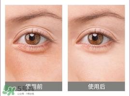 卡琳朵贵妇蛇毒眼膜贴怎么用?使用方法 卡琳朵贵妇蛇毒眼膜贴怎么用?使用方法