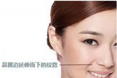 ​法令纹在什么位置 法令纹消除方法