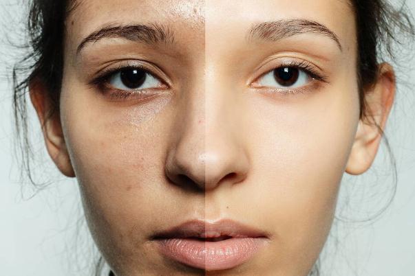 皮肤黄怎么变白 造成黄皮肤的原因有哪些 皮肤黄怎么变白 造成黄皮肤的原因有哪些