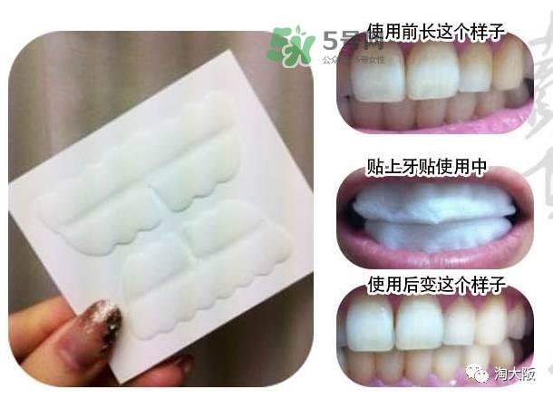 smile cosmetique牙贴怎么样_有效果吗_多少钱