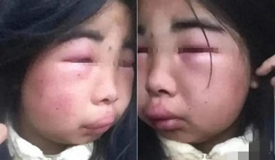 ​闹大了！女孩被8名女生轮流殴打，警方已立案！