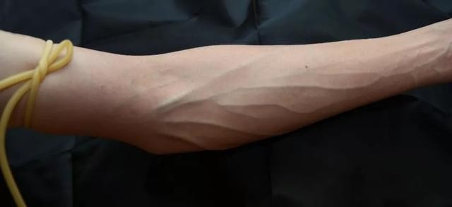 蓝血人种在哪儿（猎奇杂志里的蓝血人可能存在吗）