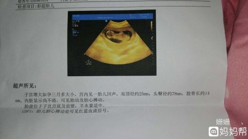 怀孕14周吃什么对胎儿好(怀孕12周胎儿彩超图)-第1张图片-