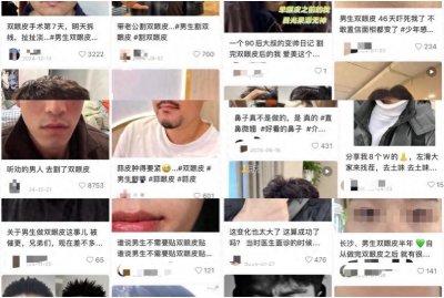 ​男生割双眼皮失败，抑郁辞职！男人们正涌进美容院……