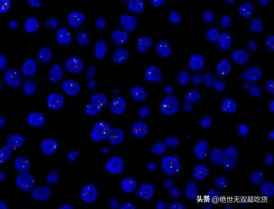 ​5分钟讲透：荧光原位杂交技术步骤和注意事项
