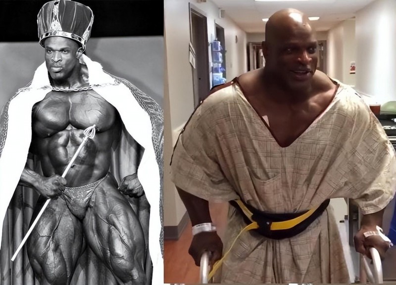 罗尼库尔曼资料介绍(罗尼库尔曼不值得为健美而死)