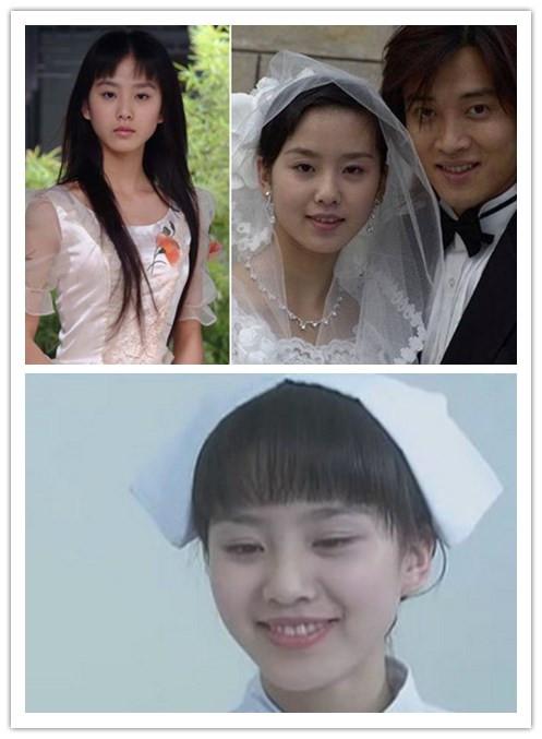 刘诗诗整容前后,刘诗诗素颜照图片(刘诗诗整容了) 刘诗诗整容前后,刘诗诗素颜照图片(刘诗诗整容了)