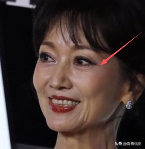 ​72岁赵雅芝变样，满脸褶子又僵又肿，被嘲医美，一代女神变老奶奶